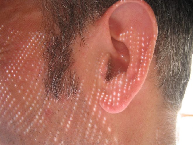 Descubren gen «maestro» que podria ayudar a revertir la perdida auditiva