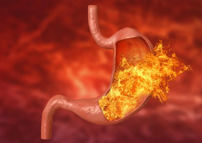 Bienvenido al mundo de la gastritis: síntomas que delatan esta enfermedad
